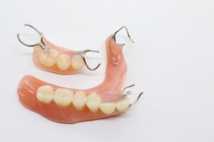 入れ歯治療のポイント