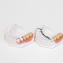 入れ歯の製作・調整